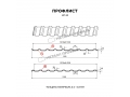 Профлист Металл Профиль МП-20x1100-R NormanMP (ПЭ-01-6019-0,5)